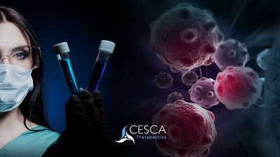 博雅旗下赛斯卡医疗将推出全球第一条全自动、全封闭的临床级CAR-T细胞CMC生产线CAR-TXpress平台