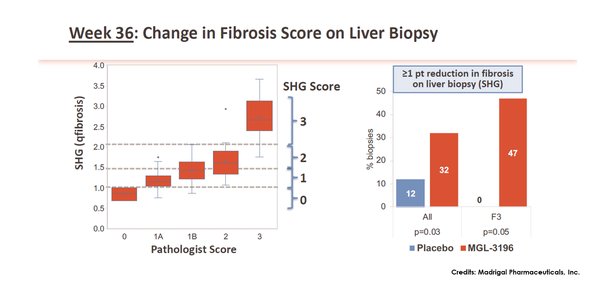 Week 36: Change in Fibrosis Score on Liver Biopsy. From: 