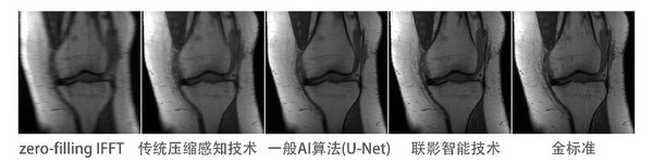 各类图像重建对比