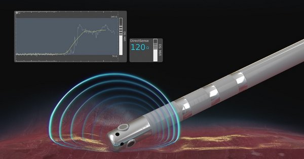 波士顿科学推出DIRECTSENSE(TM)技术