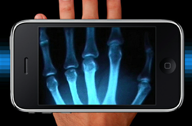 蓝菲光学：推出整套医疗成像设备的检测方案