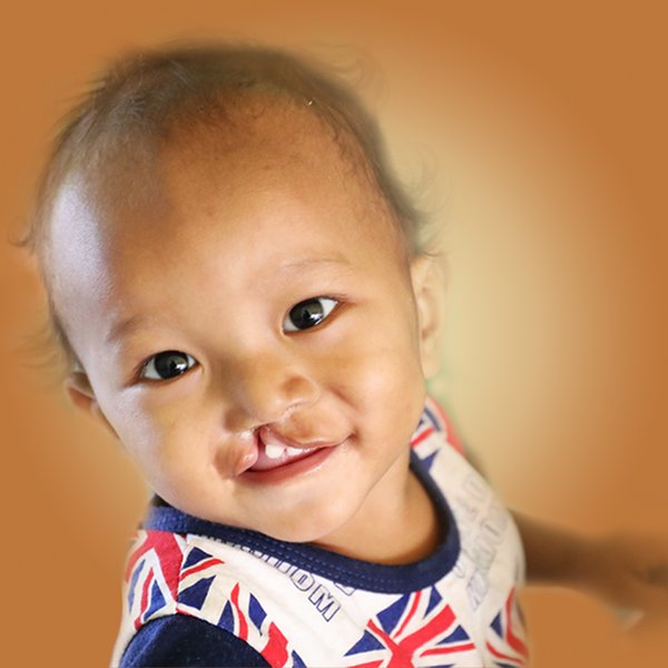 丽思卡尔顿酒店亚太区启动第五届“亚洲微笑周” 援助唇腭裂儿童