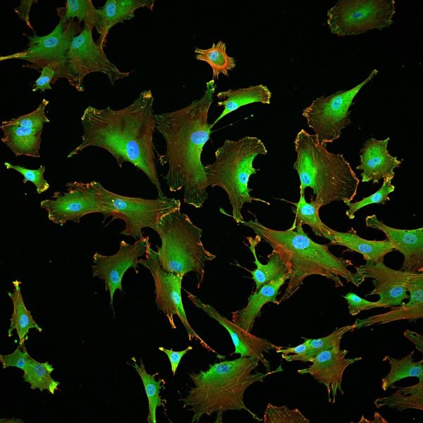 荧光标记间充质干细胞在原弹性蛋白上生长