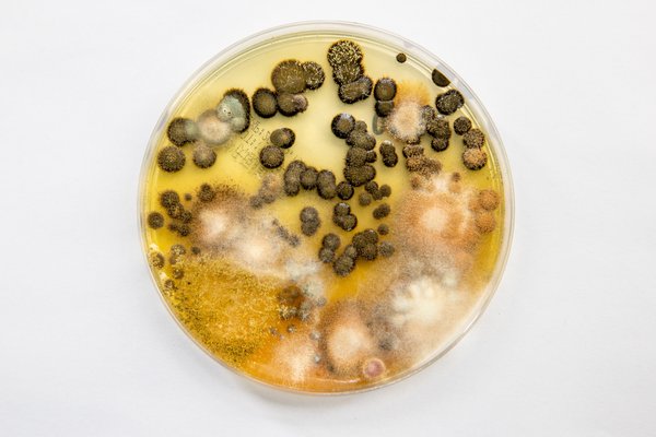 培养基中的霉菌