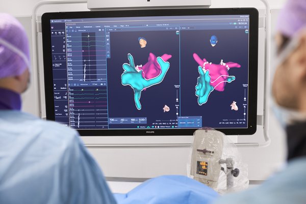 飞利浦宣布KODEX-EPD心脏成像和标测系统在中国正式上市